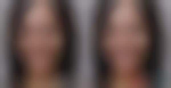 Facial Restructuring Phone Apps