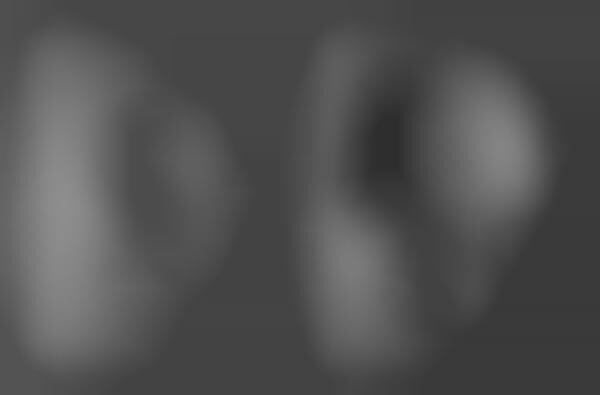 Facial Crater Photography