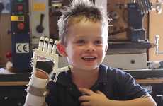 DIY Free-Sourced Prosthetics