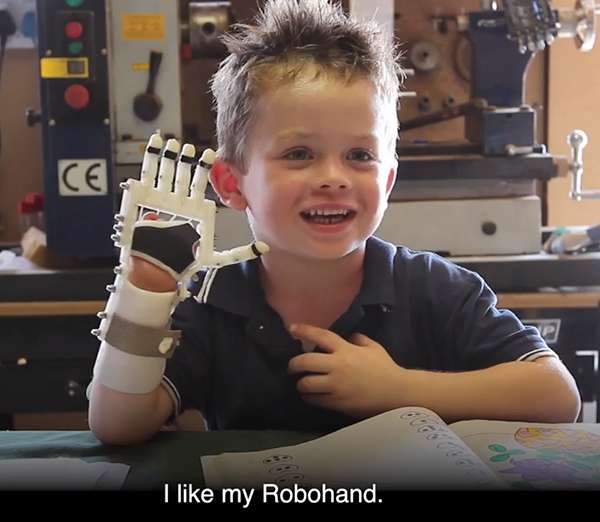 DIY Free-Sourced Prosthetics