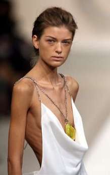 Fashion Week Told to Ban Size-Zero Models or Lose Grant