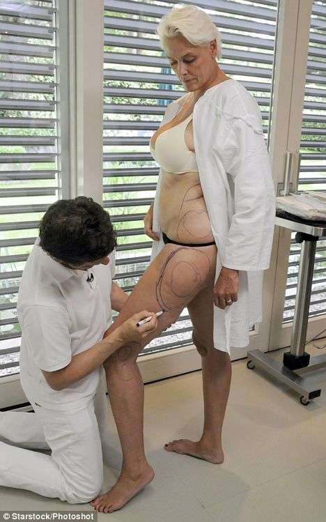 Live Celebrity Surgery