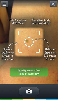 Cancer-Scanning Apps Image 2