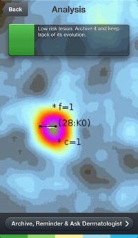 Cancer-Scanning Apps Image 4