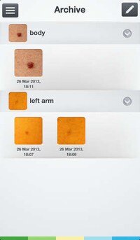Cancer-Scanning Apps Image 5