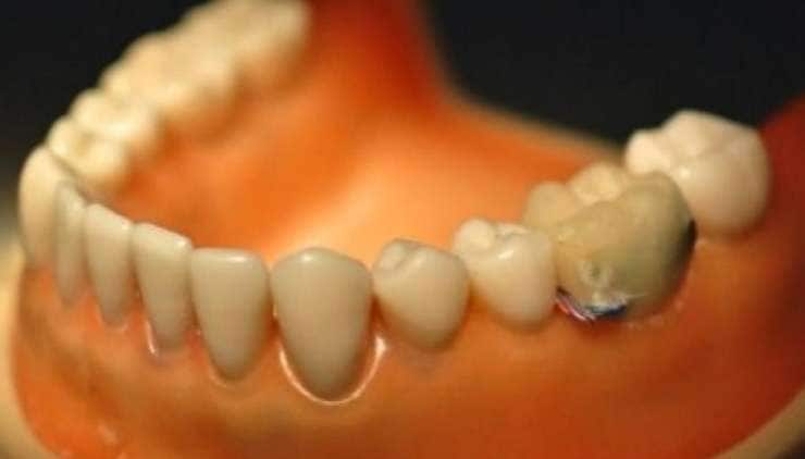 Oral Habit Trackers