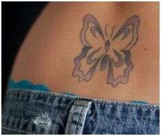 Eco Tattoo Removal