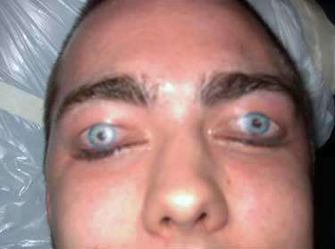 Eyelid Tattoos