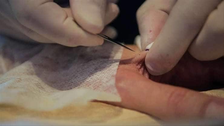 RFID Chip Tattoos