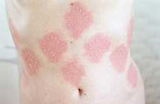 Skin-Etching Artwork