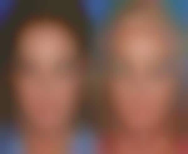 Identical Twin Aging Comparisons