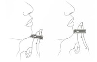 Finger-Worn Razors Image 4