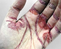 Stitched Skin Artworks Image 5