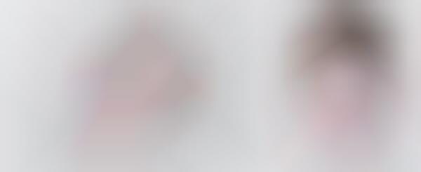 Scarred Child Portraits