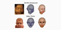 Custom 3D Printed Fetuses Image 3