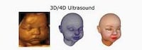 Custom 3D Printed Fetuses Image 5