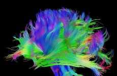 Psychedelic Brain Images