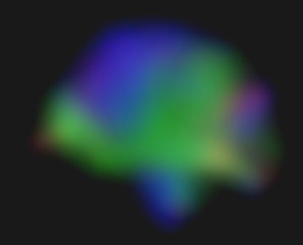 Psychedelic Brain Images