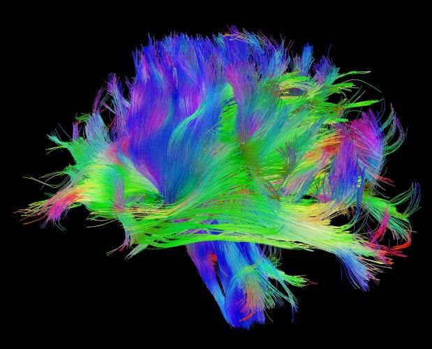 Psychedelic Brain Images
