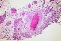 Cancer-Sensing Fruit Flies Image 2