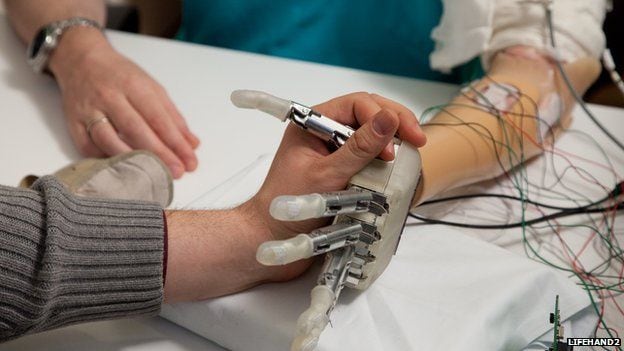 Feeling-Restoring Prosthetic Hands