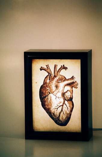 Anatomical Lightboxes