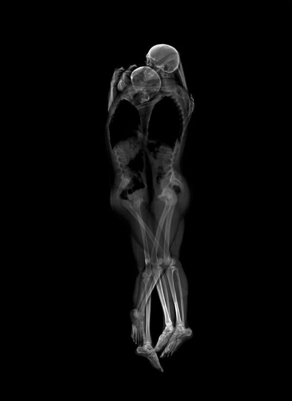 10 Examples of X-Ray Art