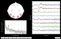 Brilliant Brain-Controlled Devices Image 3