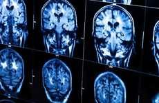 Alzheimers-Predicting Blood Tests