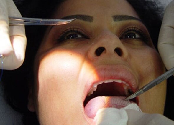 48 Extreme Diet Aids