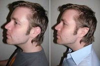 Bizarre Plastic Surgery Image 2