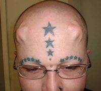 Bizarre Plastic Surgery Image 4