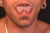 Bizarre Plastic Surgery Image 5