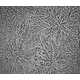 Magnified Tear Droplet Photography Image 5