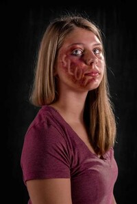 Poignant Anti-Abuse Photography Image 2