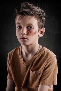 Poignant Anti-Abuse Photography Image 3