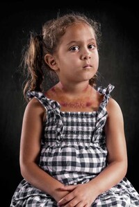 Poignant Anti-Abuse Photography Image 5