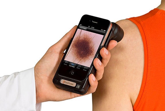 Cancer-Screening Apps