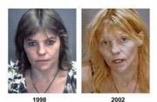 Before and After Drug Use Photos