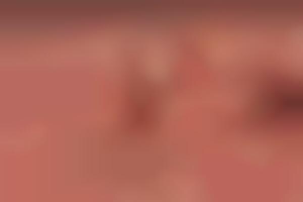 Magnified Mystery Meats