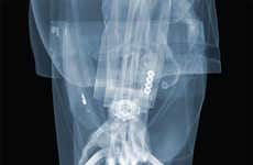 Voyeuristic X-Ray Portraits