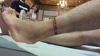 Foot Amputation Farewells Image 5