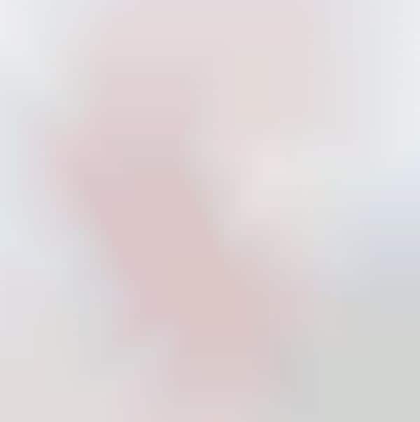 Beautiful Albino Portraits