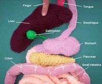 Knitting Gone Wrong Image 5