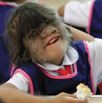 Real-Life Werewolves Image 2
