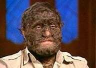 Real-Life Werewolves Image 7