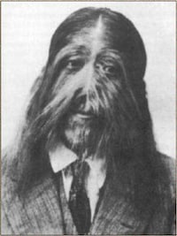 Real-Life Werewolves Image 8