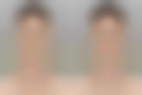 Idealized Facial Comparisons