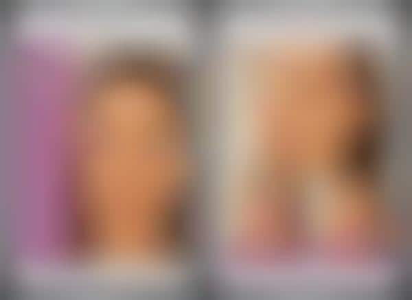 Facial Alteration Apps
