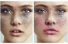 Freckle Faced Beauty Editorials